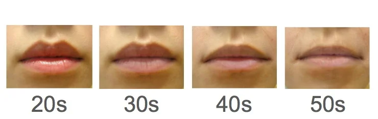 加齢とともに変化する唇のボリューム