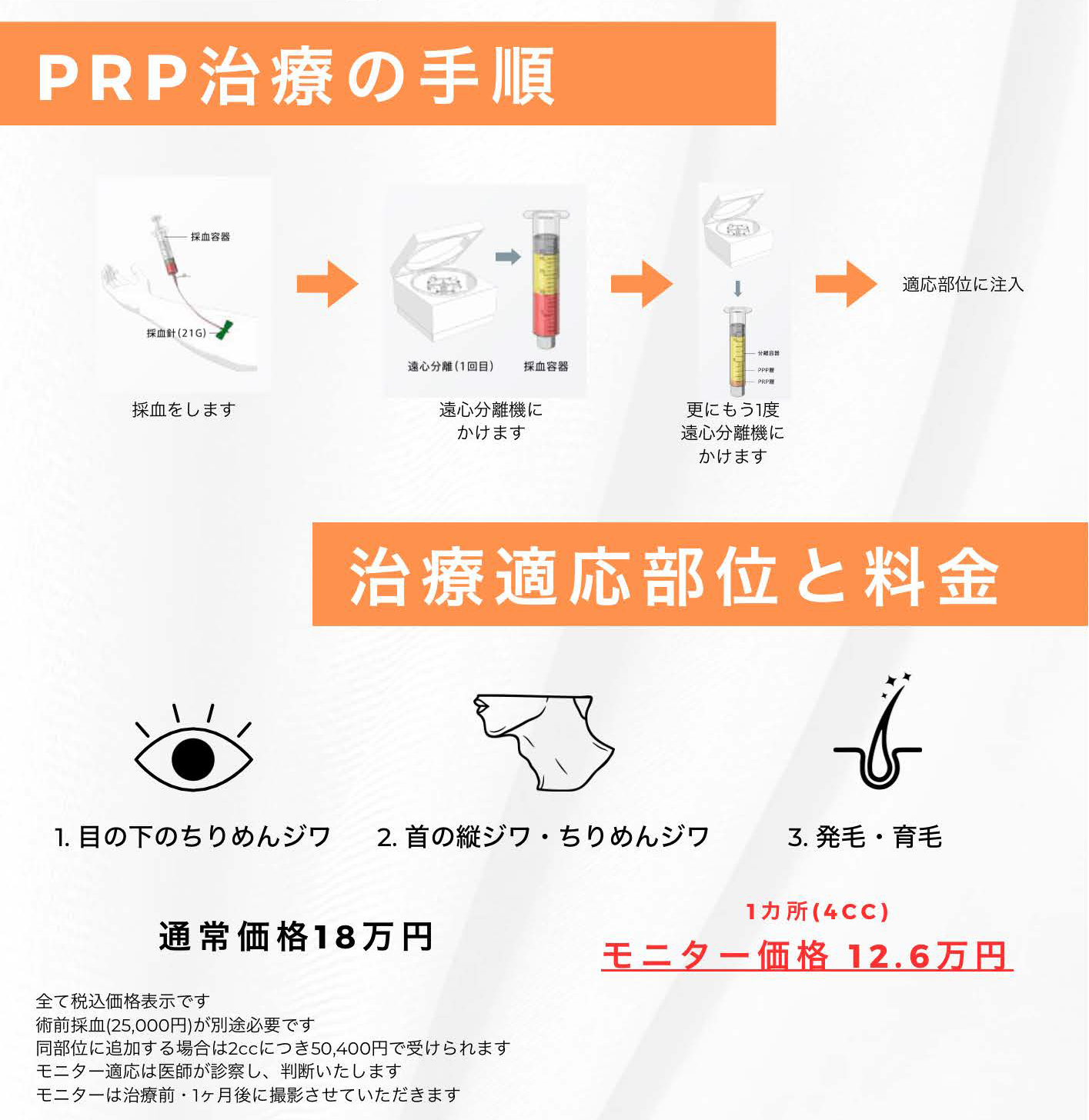 PRP治療の手順